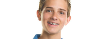Young boy with brown hair and braces smiling in front of white background.