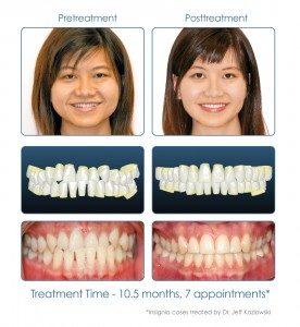 Pretreatment & Post treatment