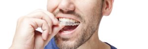 Young adult male putting in his visalign mouth piece in front of a white background.