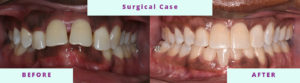 Surgical Before & After